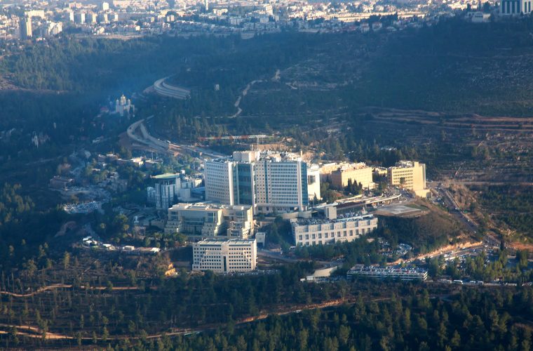 בית חולים הדסה צילום משה שי פלאש 90